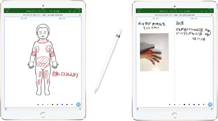 Apple Pencilによる手書きイメージ