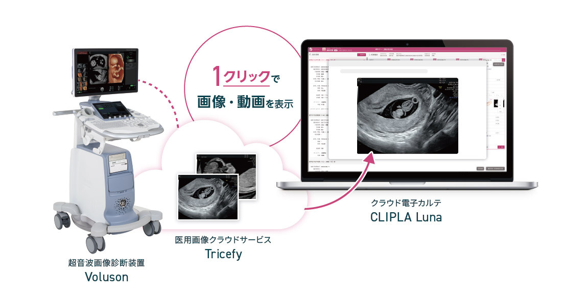 【システム連携】ルナルナ メディコ・医用画像サービスとも連携可能